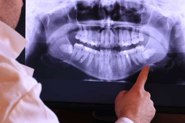 Best Emergency Broken Tooth Repair in Hammonton, NJ